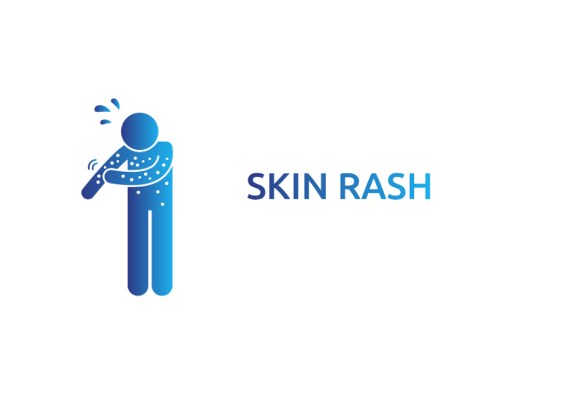 Skin rash 
